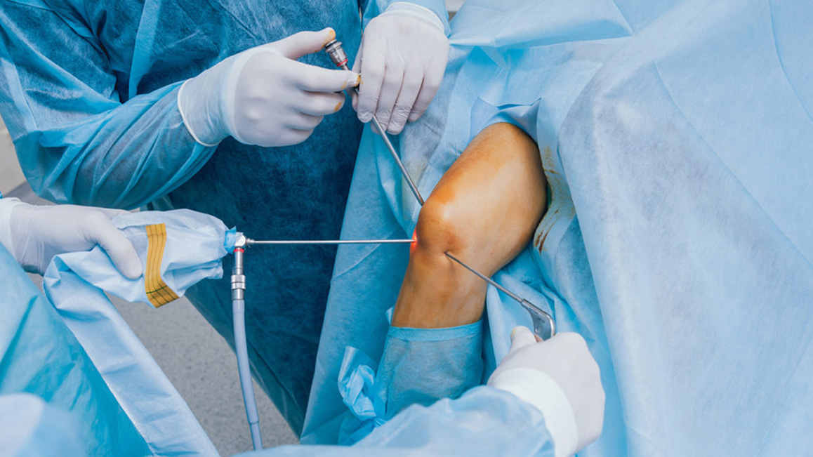 Trauma and Arthroscopy